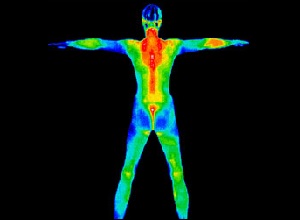 Hyperthermie