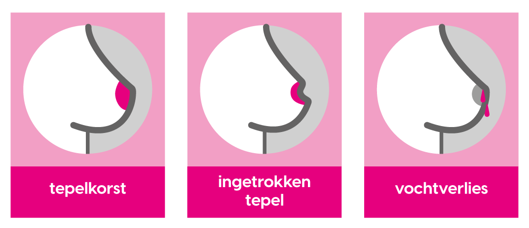 Symptomen van borstkanker | Ribbon