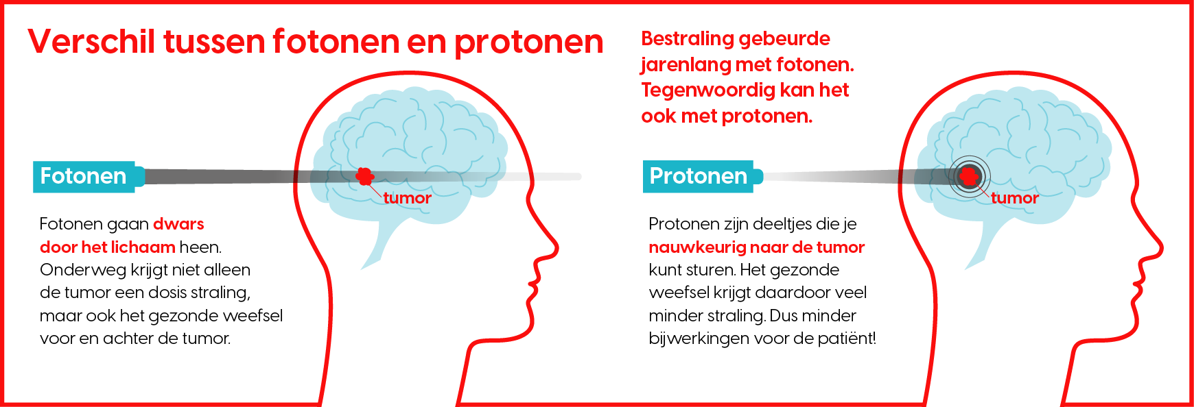 protonentherapie infographic