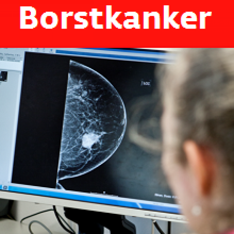 vrouw krijgt op beeldscherm naar mammografie