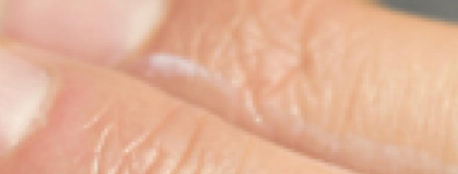 Iemand smeert arm in met zonnebrandcreme